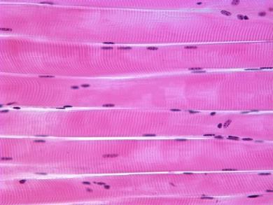 Striated (Skeletal) Muscle Tissue 4.3 Muscular Tissue Moves the Body B.