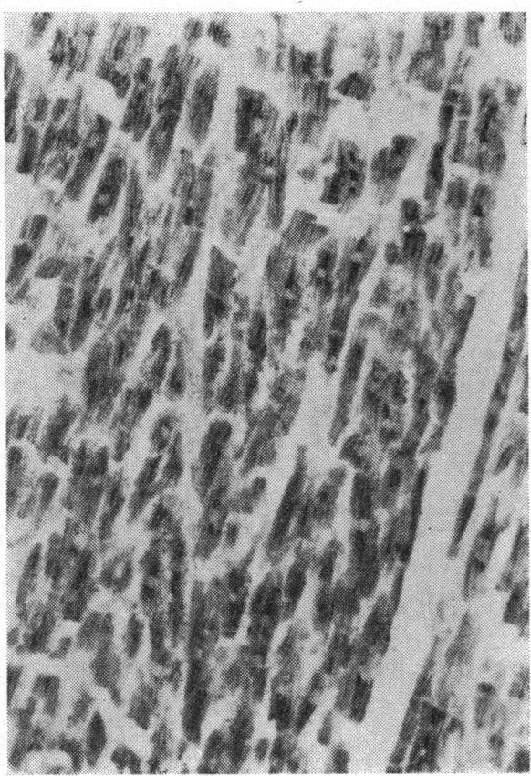 118 j~~~~~j FIG. 3.-Human myocardium (left ventricle). Shows MAO activity in sarcoplasmic reticulum and, especially, around sarcolemmal nuclei. (x 127.