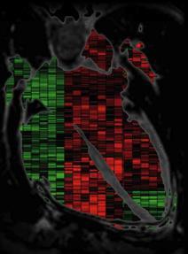Abnormal Signaling in Hearts of Lmna H222P/H222 Mice
