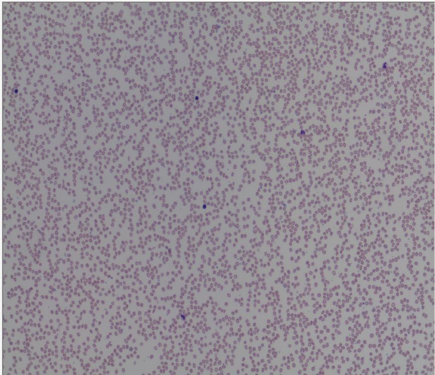 Leukocytes (10x) HemoFAXS acquires morphology pictures for morphological