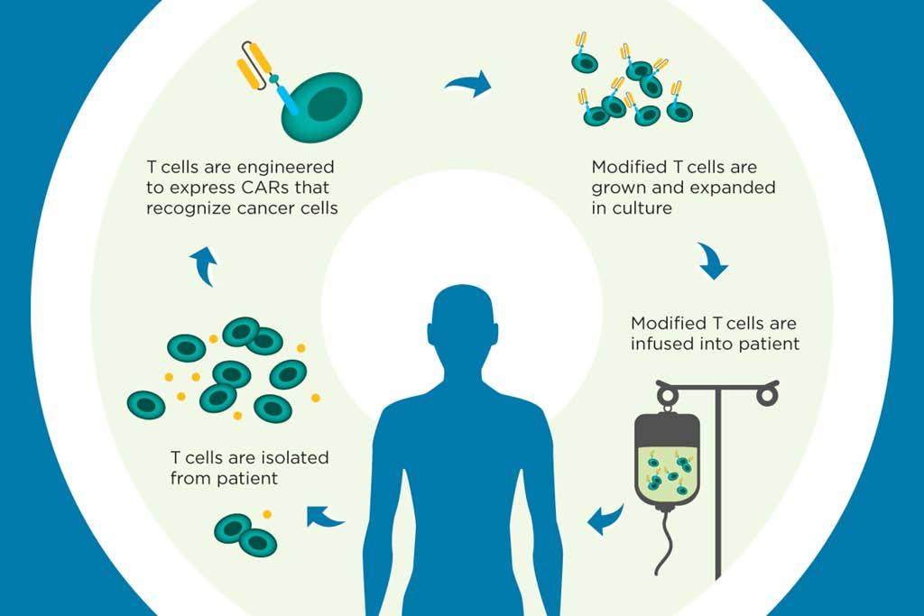 Clinical development of cancer antigen-based vaccine and engineered T cell Immunotherapy CAR-engineered T cell immunotherapy What is Next for Cancer Immunotherapy?