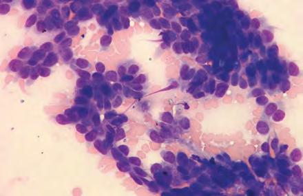 CyTOLOgy Of NeOPLASiA: AN essential COmPONeNT Of DiAgNOSiS Figure 1. Canine trichoblastoma: The mass was raised and hairless.