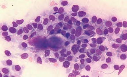 Histopathologically, hemangiosarcomas are occasionally described as epithelioid and have solid areas, which result in a more cellular aspirate.