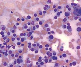 CyTOLOgy Of NeOPLASiA: AN essential COmPONeNT Of DiAgNOSiS plasma Cell tumors histiocytomas Mast Cell tumors lymphoma transmissible Venereal tumors Table 3.
