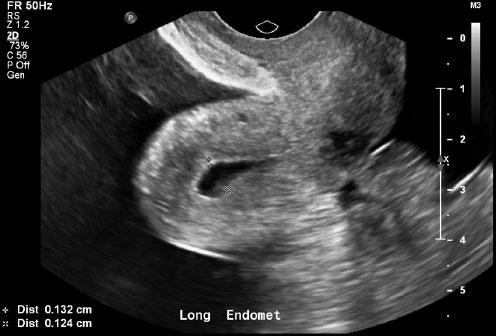 270 Journal of Diagnostic Medical Sonography 32(5) Figure 1.