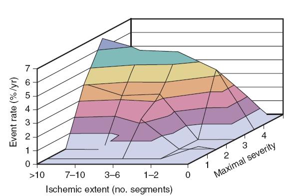 Cumulative effect of ischemic extent and maximal severity (jeopardized