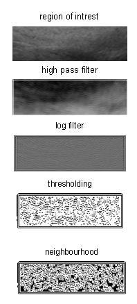 So the color Image to gray scale Image conversion is very important, except when we need to extract color textural features. An example of ultrasound image and two ROIs selected is shown in Figure 1.
