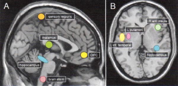 Hölzel et al. 2008. Vestergaard-Poulsen et al.2009. Luders et al. 2009. Activation during Meditation Prefrontal Anterior Cingulate Insula Hippocampus Lou et al. Human Brain Mapping 1999. Lazar et al.