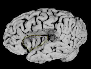 Cognitive & affective response Amygdala Mediates stressrelated behavior Hippocampus