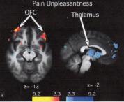 related to brain regions Important for understanding pain The Journal of
