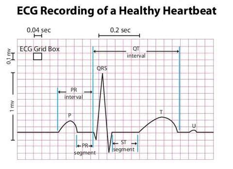 Additional information can be found http://www.nhlbi.nih.gov/health/healthtopics/topics/hhw/electrical.html (Garcia & Miller, Basic Beat, 2004) Chapter 3.