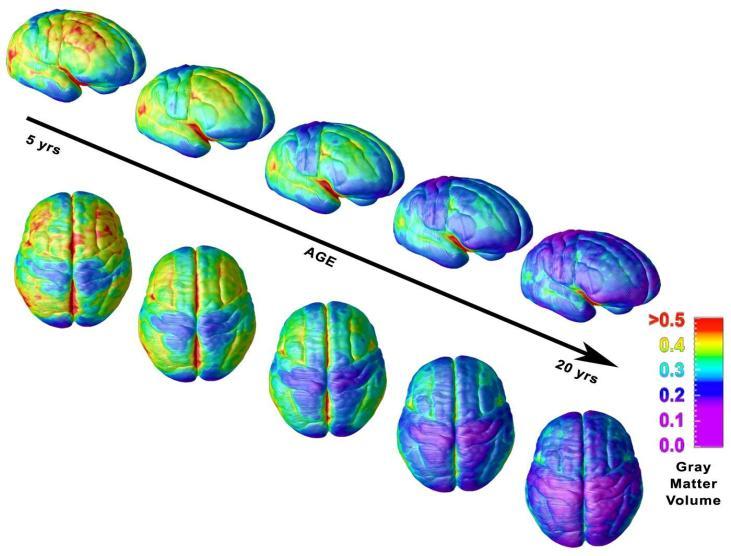 Adolescent Brain Changes smri WM GM EEG Delta sleep