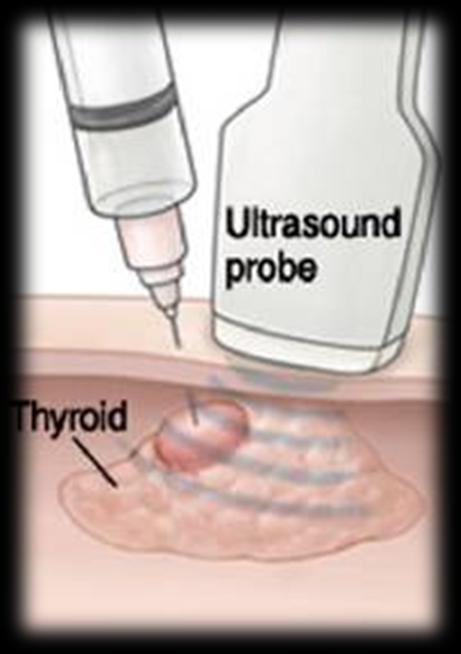 Biopsy Procedure Description of procedure to patient Review of ultrasound
