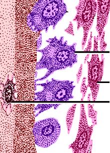 an epithelioid layer locate on the surface of new bone tissue