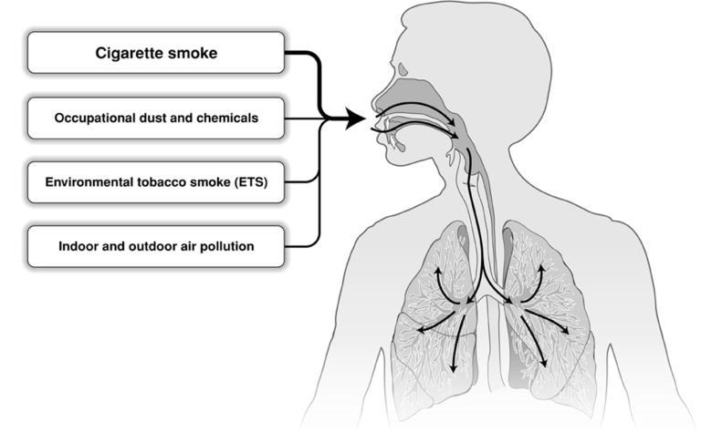 Chronic Respiratory Diseases: Shared Risk Factors Genes Infections Socio-economic status