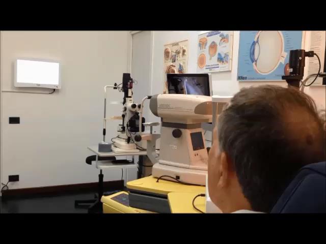 Surgeon : Burkhard Dick Bochum - Germany J&J Catalys Femto Assisted Cataract Surgery Right Eye BCFV 20/25-8 sph Right Eye AT LISA tri + 10.00 D Left Eye BCFV 20/25-8 sph - 1.