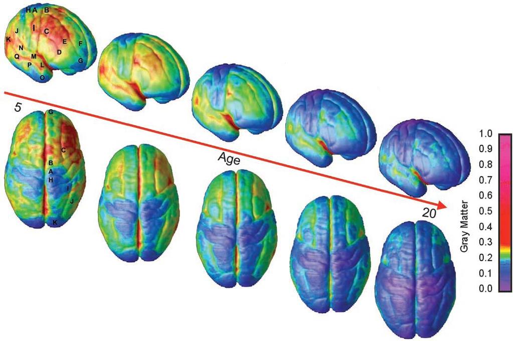 RECORDING Structure Brain Changes in Development Courtesy of National Academy of Sciences, U.S.A. Used with permission. Source: Gogtay, N., et al.