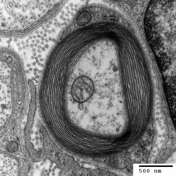 Myelinated Nerve Fiber Trinity College Electron Microscopy Facility (Ann Hein Lehman). License CC BY-SA.