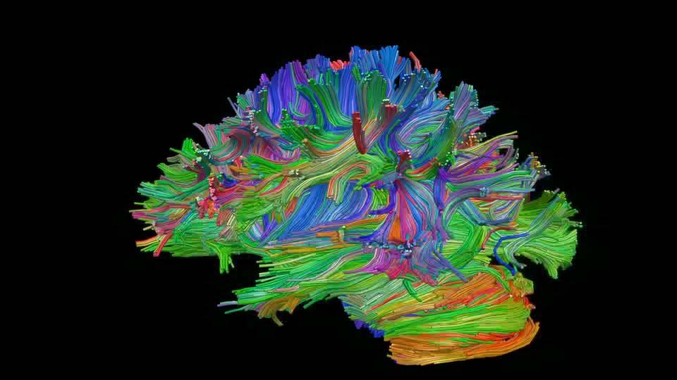 Diffusion Tensor Imaging (DTI) Tractography red = left-right; blue = up-down;
