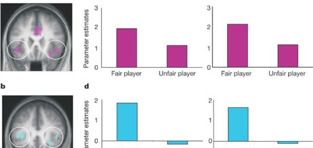 insula Women Empathy Perceived Fairness of Others Feeling: Pain > No Pain Conj.