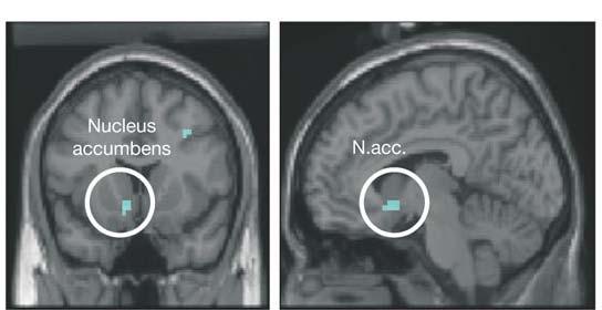 Empathy Perceived Fairness of Others Gender Differences Nucleus