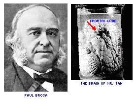 Paul Broca (1824-1880) source unknown. All rights reserved.