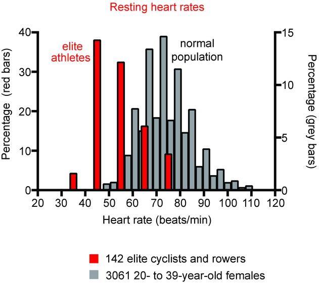 The athlete's heart J Physiol.
