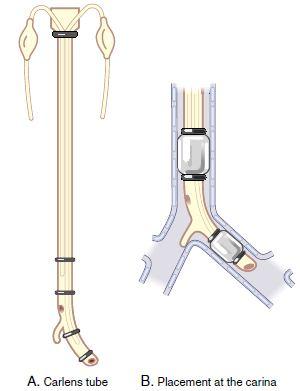 A. Diagram of the Carlen s red rubber tube B.