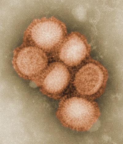 Influenza-1918-2018.
