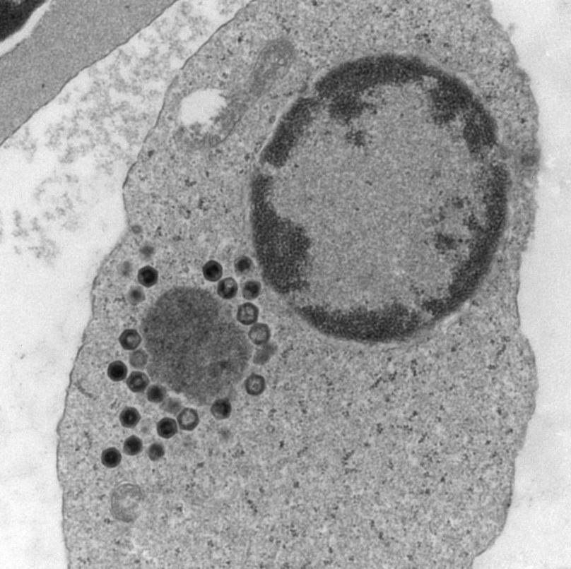 2.2.7 Viral Erythrocytic Necrosis - 6 Nucleus Inclusion Body Virions Figure 3.