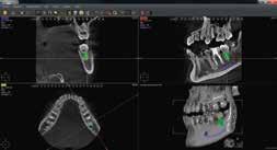 with its compact 5x5cm volume, will enable you to view cross-section images of patients teeth,