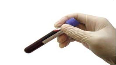Blood-work Blood work can yield some very important information about