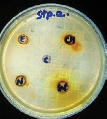 The fungal strains used in this study were namely A. flavus, A. niger, Penicillium and white rot fungi.