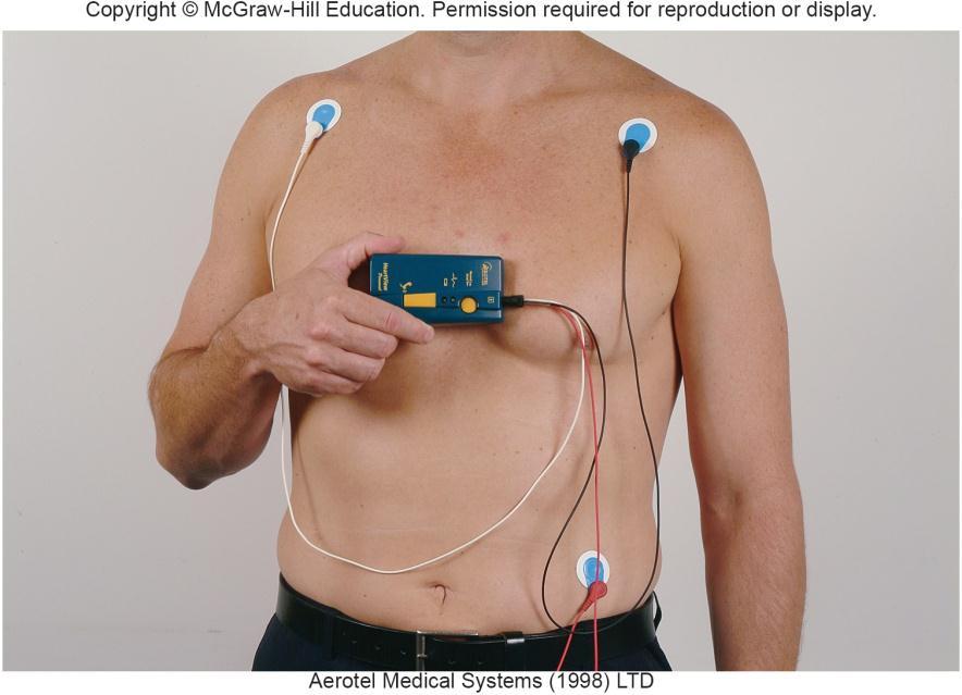 12.1 Ambulatory Monitoring Process of recording an ECG tracing while patient performs daily activities Typical