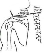 GB-21 In the trapezius spit midway between C7 spinous process and the