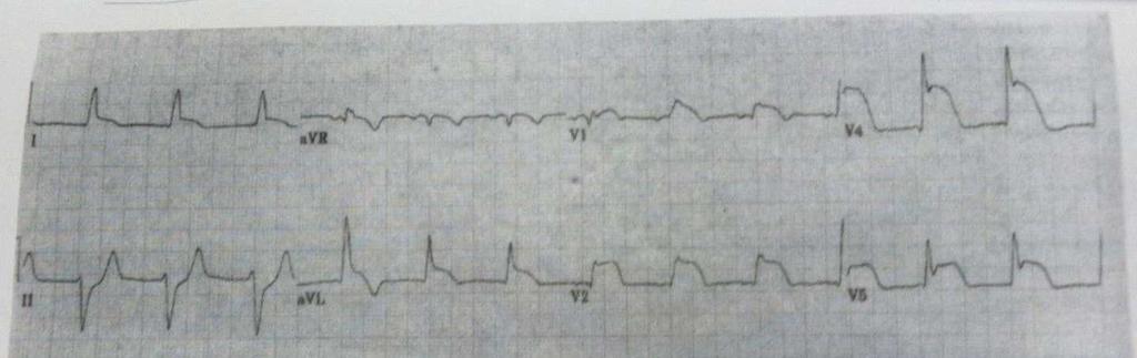 This patient is a healthy 91 year old female with distant history of stroke