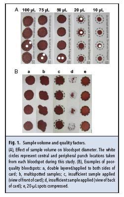 The quality of the spot Effect of Dried Bloodspot Quality on Newborn Screening Analyte Concentrations Roanna S. Georgeand Stuart J. Moat Clin Chem 2016 (P< 0.001).
