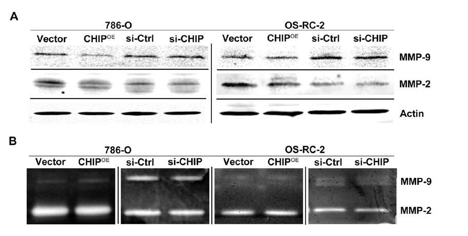 Revised Supplementary Fig. S3: CHIP levels did not affect the expression of MMP-2 and MMP-9.
