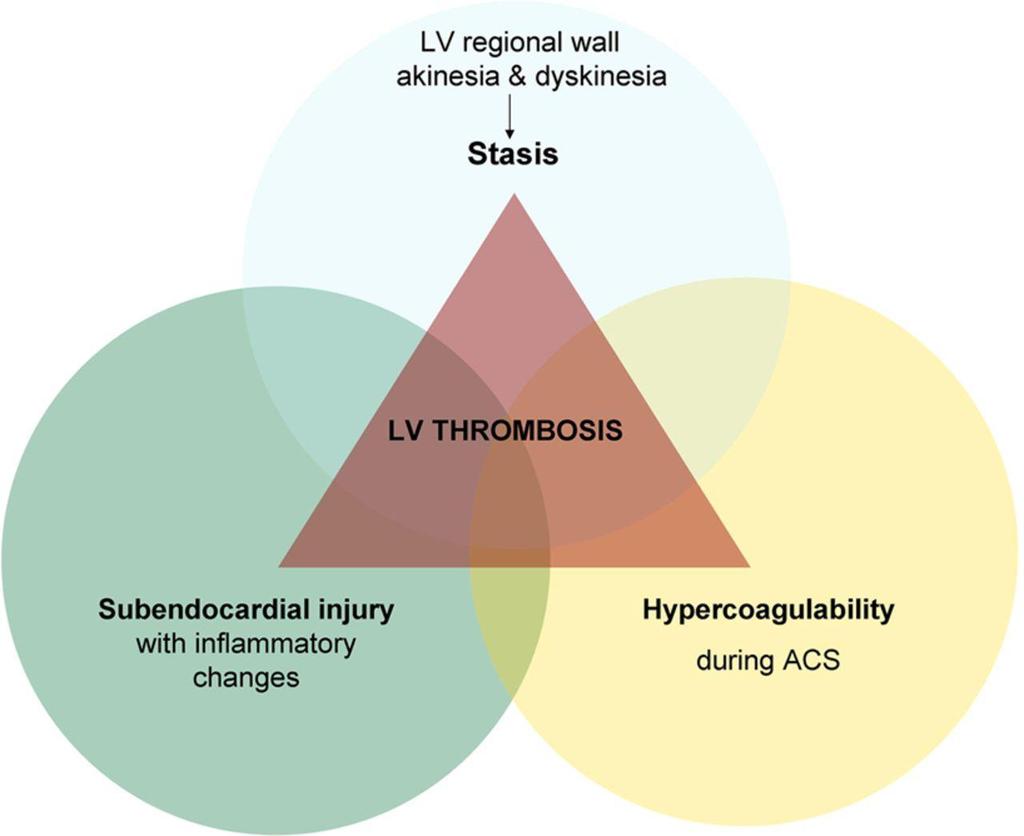 The three components of the Virchow's triad in left ventricular