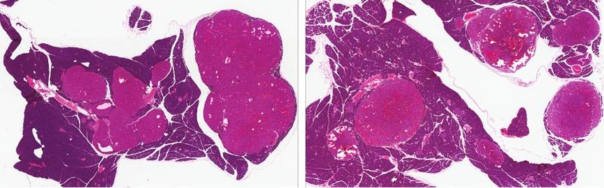 Loffler et al. BMC Cancer 2012, 12:252 Page 4 of 7 Men1 +/- : Trp53 +/+ Men1 +/- : Trp53 +/- Figure 2 Pancreatic pathology.