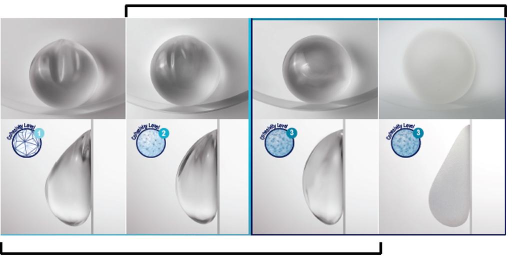 38 Gabriel and Maxwell. Implant selection in prepectoral breast reconstruction From stable Round implants Anatomic implant Figure 2 Natrelle round and anatomic implants.