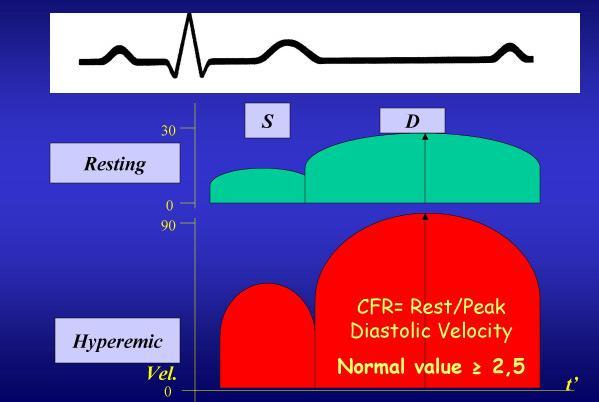 Coronary flow HR and the coronary arteries