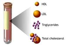 How to Detect High Cholesterol? High cholesterol is detected by a simple blood test for cholesterol (after 8 hours of fasting).