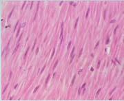 Tissue voluntary muscle (skeletal muscle) is found in