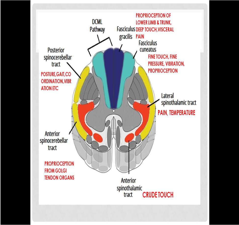 DIAGNOSTIC WORK UP HISTORY PHYSICAL EXAMINATION NEUROLOGICAL EXAMN:- MOTOR,SENSORY AND REFLEXES BROWN SEQUARD SYNDROME AUTONOMIC REFLEXES BOWEL AND BLADDER SYMOTOMS FOLLOWED
