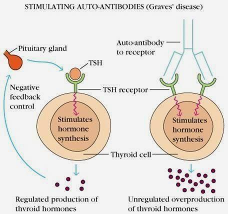 Normal event Organ specific autoimmune diseases Graves diseases Thyroid stimulating hormones (TSH) binds to thyroid cells receptors and stimulate the synthesis of two thyroid