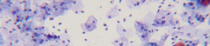 BENIGN CELLULAR CHANGES 1 119-Cellular Changes due to Inflammation: 10X magnification picture of