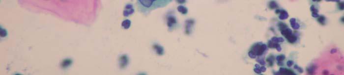132-Actinomyces species: 40X picture of an