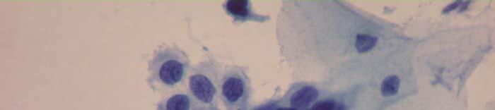 The cells are round, oval (size of parabasal cells), the cell