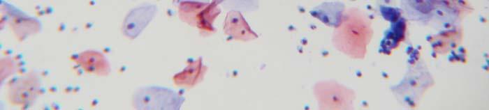 114-Negative within Normal Limits: 10x magnification picture shows a well dispersed population p of